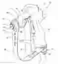 Fig. 01 - FLUID SPRAY GUN, FILTER FOR SUCH A GUN, AND METHOD FOR EXTRACTING A FILTER OUT OF SUCH A GUN