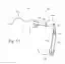 Fig. 33 - Apparatus for human arm supporting exoskeleton