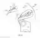 Fig. 06 - Single-blade razor apparatus