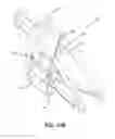 Fig. 18 - ELECTRIC BICYCLE BATTERY ANTI-THEFT DEVICE AND METHOD
