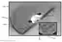 Fig. 01 - Aeration discs and methods for using same