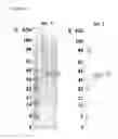 Fig. 07 - RECOMBINANT SOLUBLE HUMAN TISSUE FACTOR, METHOD OF ITS PRODUCTION AND USES THEREOF