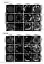 Fig. 08 - Modulators of ROR1-ROR2 binding