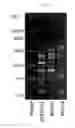 Fig. 02 - Lactic acid bacterium having IgA production promoting activity, and use thereof