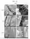 Fig. 02 - IN VITRO FIBROSIS MODEL, PREPARING METHOD THEREFOR, AND USE THEREOF
