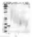 Fig. 07 - Modified DNase and uses thereof