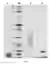 Fig. 26 - Modified DNase and uses thereof