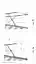 Fig. 10 - Smart ladder