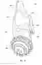 Fig. 09 - Drill bit with self-directing nozzle and method of using same