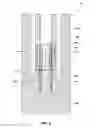 Fig. 04 - Coring tools including core sample flap catcher and related methods