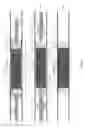 Fig. 07 - Well restimulation downhole assembly