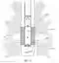 Fig. 17 - Sealing an undesirable formation zone in the wall of a wellbore