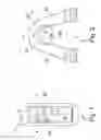 Fig. 02 - Gear device for fitting to a drive shaft