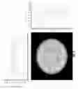 Fig. 06 - Cylindrical light diffusing device for use in photoimmunotherapy