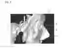 Fig. 09 - TRAINING APPARATUS FOR ENDOSCOPIC ENDONASAL SKULL BASE SURGERY