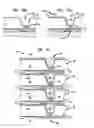 Fig. 27 - Staged via formation from both sides of chip