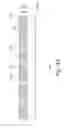Fig. 07 - Multi-layer leadless semiconductor package and method of manufacturing the same