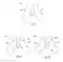 Fig. 03 - Hearing device with bowtie antenna optimized for specific band