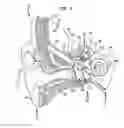 Fig. 02 - Implantable transducer system