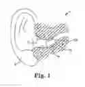 Fig. 02 - Photoactive self-cleaning hearing assistance device