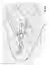 Fig. 23 - Row digger