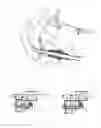 Fig. 04 - Stepless variable speed control mechanism for a lawn mower