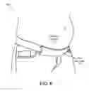 Fig. 07 - ADJUSTABLE MATERNITY PANT EXPANDER