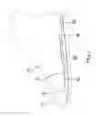 Fig. 05 - Shoe insert assembly
