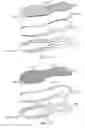 Fig. 05 - Article of footwear having a midsole with multiple portions and method of making the same