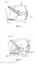Fig. 07 - Lace guide for an article of footwear