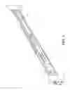 Fig. 02 - Bracket device