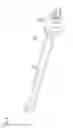 Fig. 06 - Endoscopic surgery device, method of inserting endoscope and treatment tool, and method of removing endoscope and treatment tool