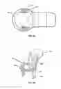 Fig. 03 - Electronic adaptor for stereoscopic field of view through a port
