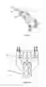 Fig. 11 - Electronic adaptor for stereoscopic field of view through a port