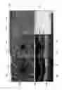 Fig. 03 - Ophthalmic image display device and ophthalmic imaging device