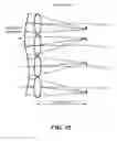 Fig. 37 - Apparatus and method of determining an eye prescription