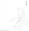 Fig. 02 - Measurement of ocular parameters using vibrations induced in the eye