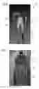 Fig. 06 - Method and apparatus for provision of preparatory information for magnetic resonance imaging