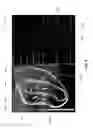 Fig. 07 - Flexible high-density mapping catheter