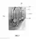 Fig. 09 - Flexible high-density mapping catheter