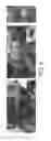 Fig. 07 - Dry electrode for bio-potential and skin impedance sensing and method of use