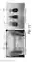 Fig. 09 - Dry electrode for bio-potential and skin impedance sensing and method of use