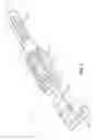 Fig. 02 - Medical Information Bracelet