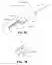 Fig. 16 - Image guided catheters and methods of use