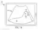 Fig. 08 - Systems and methods for controlling visualization of ultrasound image data