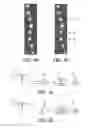 Fig. 05 - TGC controls for an ultrasonic diagnostic imaging system