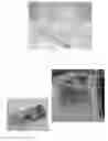 Fig. 03 - String phantom with four independent parameters for evaluation of doppler ultrasonography instruments