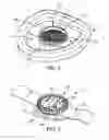Fig. 03 - Microorganism sampling method, microorganism sampling device and sampling kit comprising such a sampling device