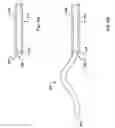 Fig. 10 - Stylet and Needle Combinations Used to Collect Tissue Samples During Endoscopic Procedures