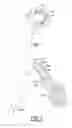 Fig. 02 - Methods and devices for accessing and retracting a capsule of a joint